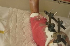 noha-tomase-suchanka